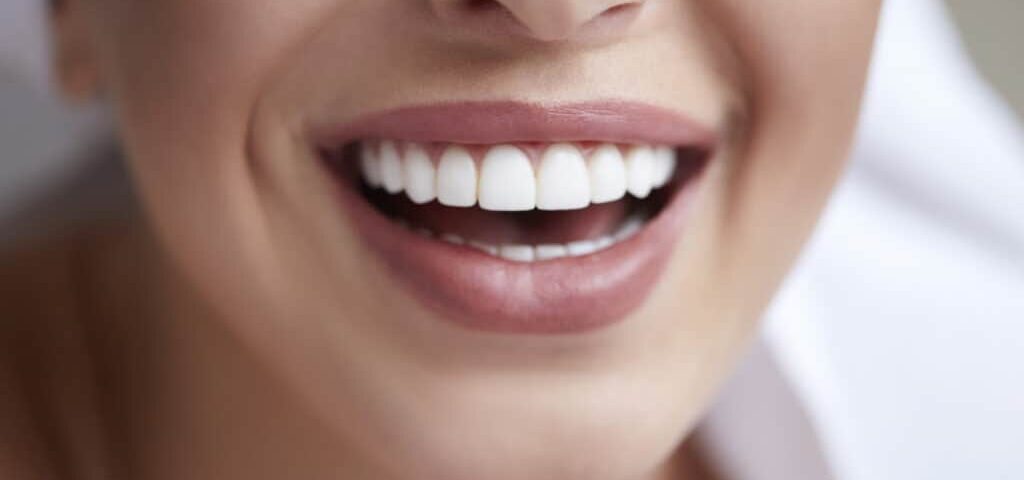 The Benefits of Veneers