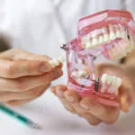 The Role of Dental Implants in Restoring Confidence