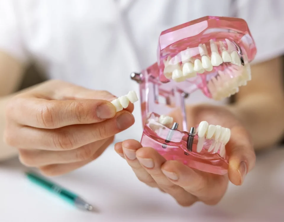 The Role of Dental Implants in Restoring Confidence