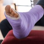 Signs You Might Have Suffered an Ankle Fracture