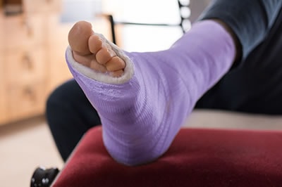 Signs You Might Have Suffered an Ankle Fracture
