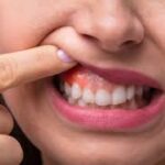 The Different Levels of Periodontist Specialization