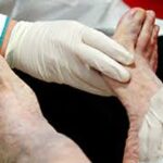 The Role of a Podiatrist in Foot Health and Well-being