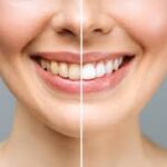 Transformative Procedures Offered by Cosmetic Dentists