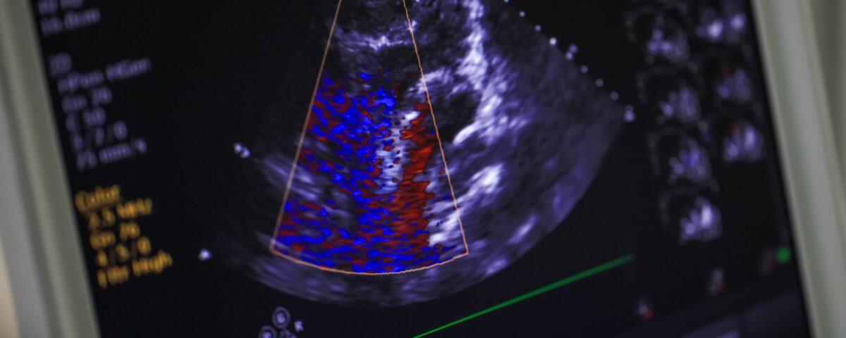 What Heart Problems Can Echocardiograms Detect?
