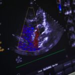 What Heart Problems Can Echocardiograms Detect?