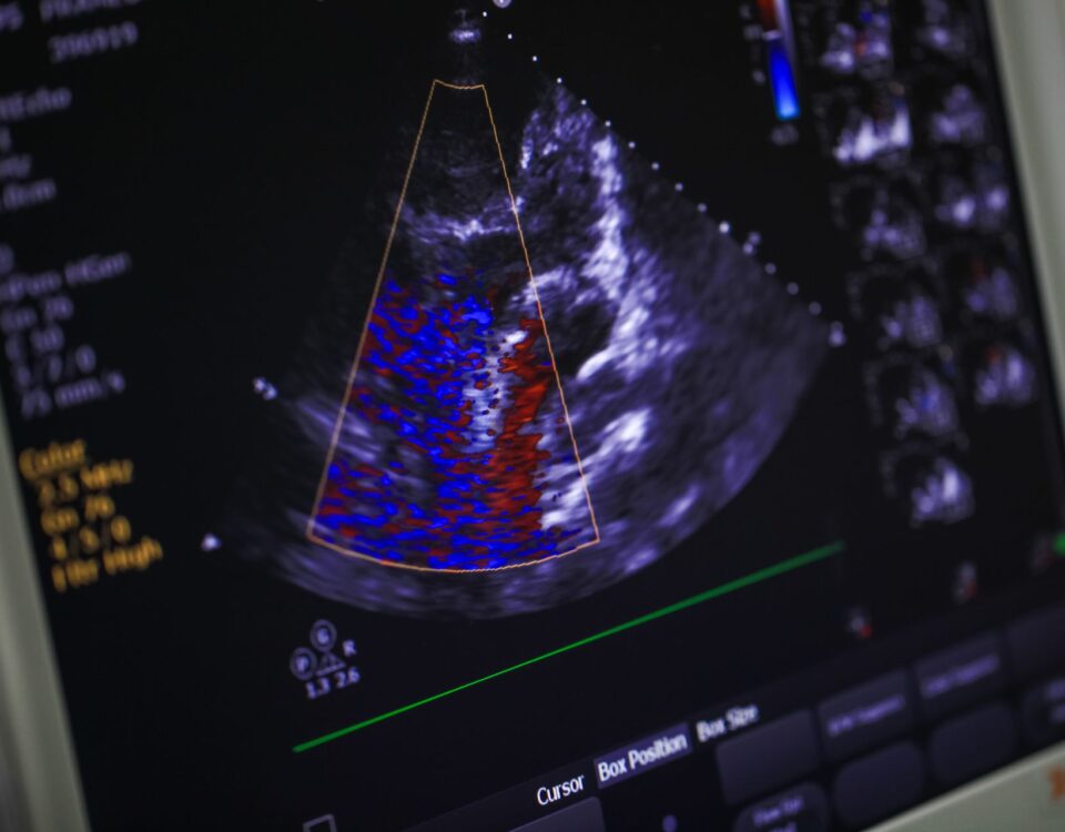 What Heart Problems Can Echocardiograms Detect?
