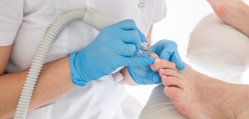 Managing Fungal Nails With Help From Your Podiatrist