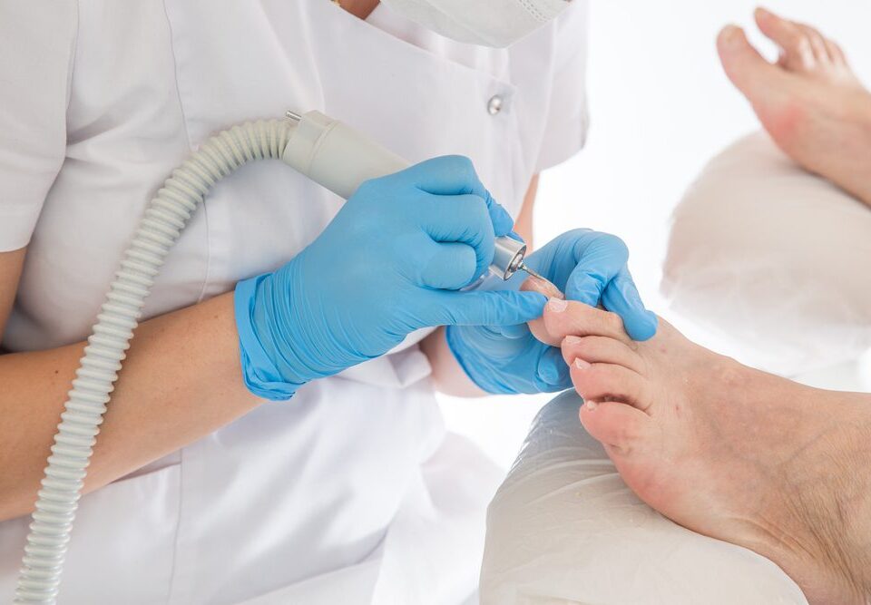 Managing Fungal Nails With Help From Your Podiatrist