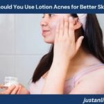 How Often Should You Use Lotion Acnes for Better Skin