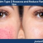 How Do You Calm Type 2 Rosacea and Reduce Flare-Ups