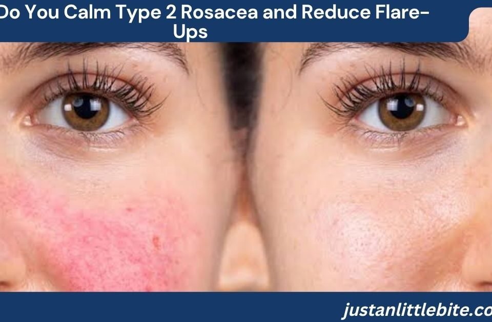 How Do You Calm Type 2 Rosacea and Reduce Flare-Ups